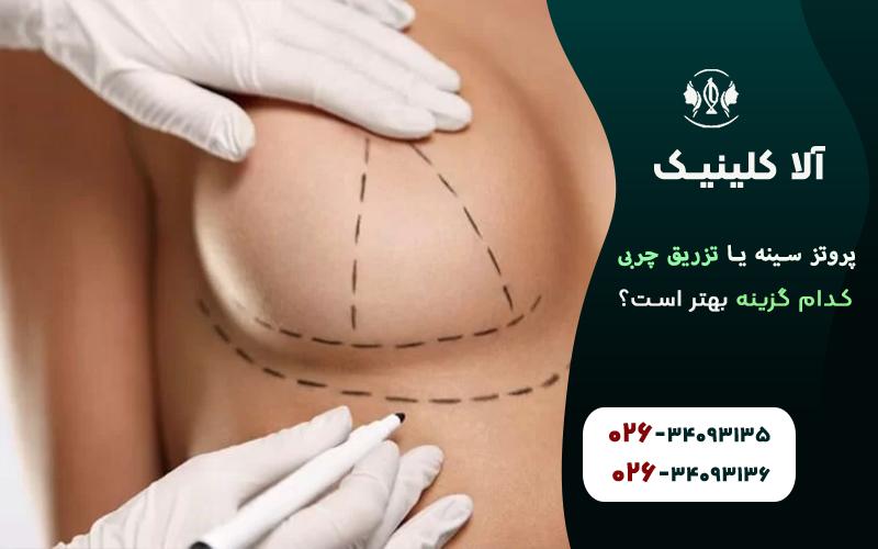 پروتز سینه یا تزریق چربی