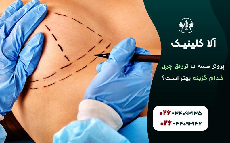 پروتز سینه یا تزریق چربی، کدام گزینه بهتر است
