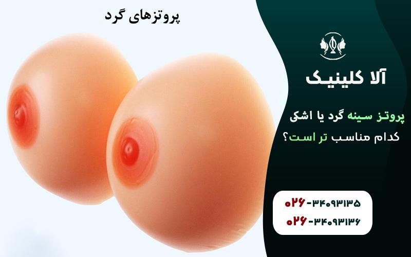 پروتز گرد مناسب تر است یا پروتز قطره اشکی