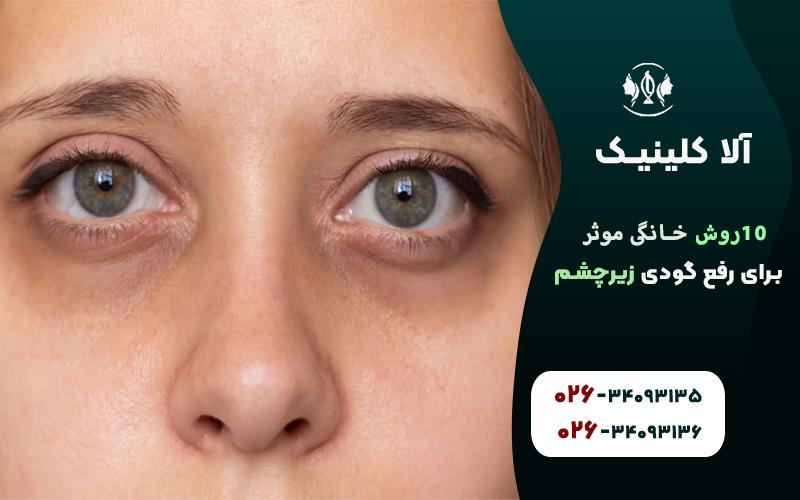١٠روش خانگي موثر براي رفع گودي زير چشم