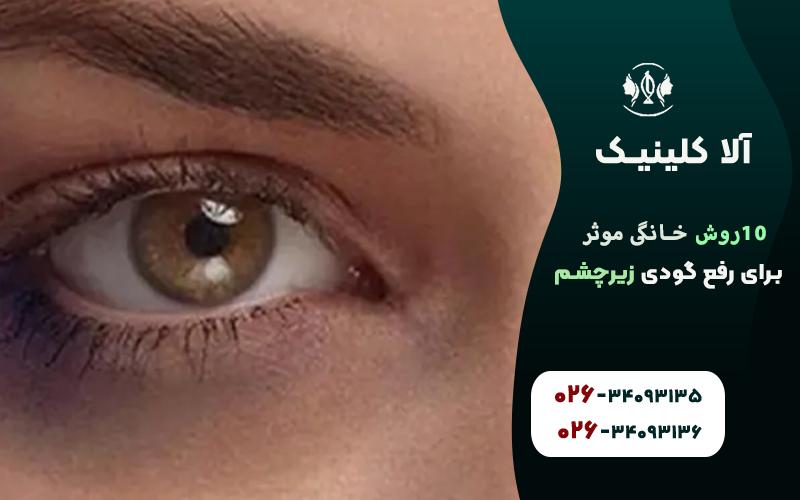 ١٠روش خانگي موثر براي رفع گودي زير چشم