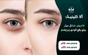 ١٠روش خانگي موثر براي رفع گودي زير چشم