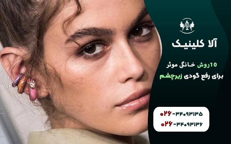 روش های خانگي موثر براي رفع گودي زير چشم