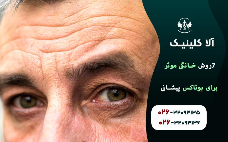 ٧ روش خانگي موثر براي بوتاكس پيشاني