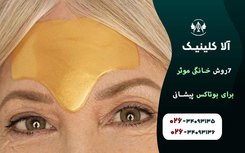 روش خانگي موثر براي بوتاكس پيشاني