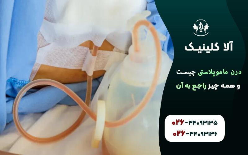 کاربرد درن ماموپلاستی