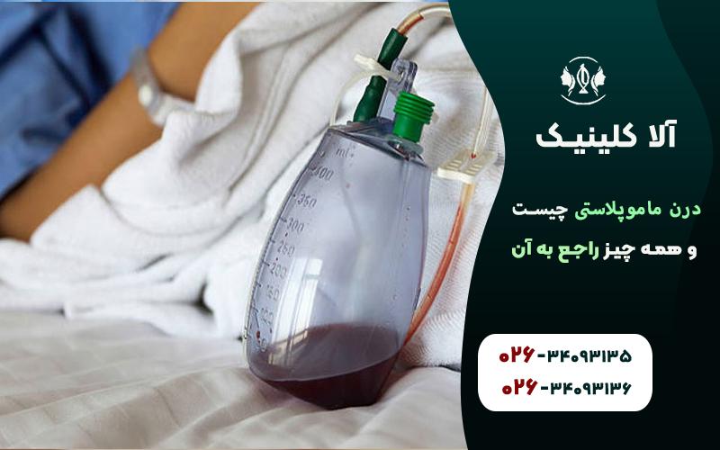 درن ماموپلاستی چیست