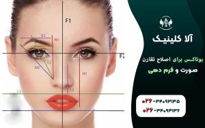 بوتاکس برای اصلاح تقارن صورت و فرمدهی
