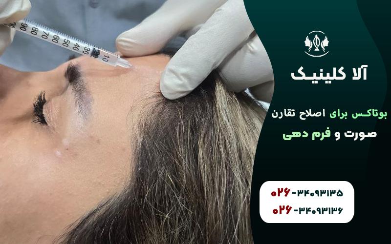 بوتاکس برای اصلاح تقارن صورت و فرمدهی