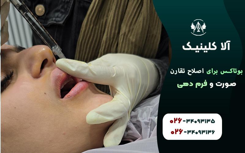 اصلاح تقارن صورت و فرمدهی به لب ها