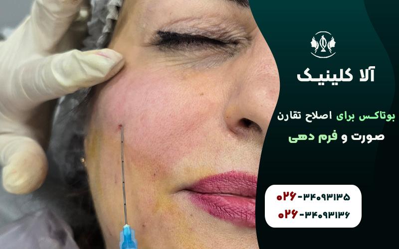 اصلاح تقارن صورت به کمک ژل