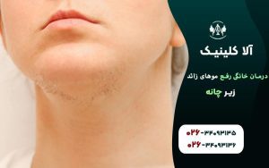 درمان خانگي رفع موهاي زائد چانه