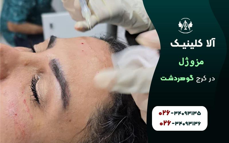 مزوژل در کرج