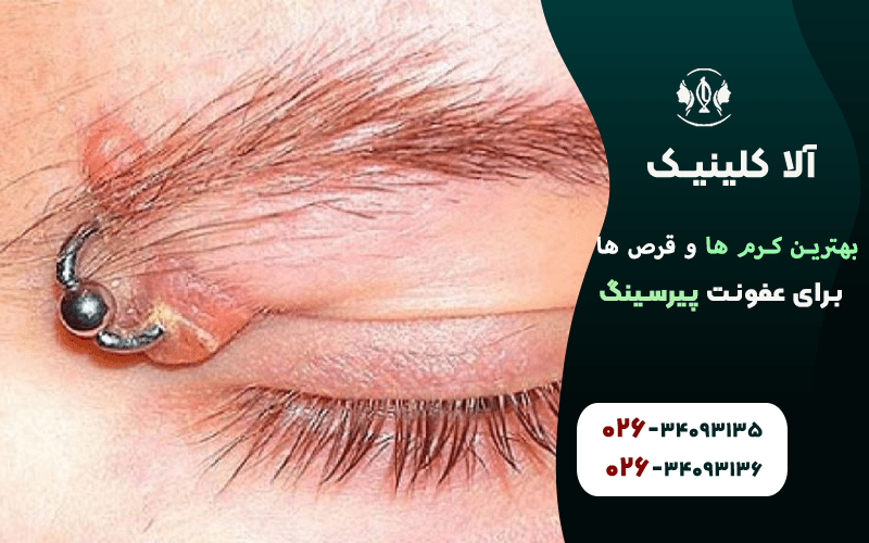 بهترین کرم ها و قرص ها برای عفونت پیرسینگ