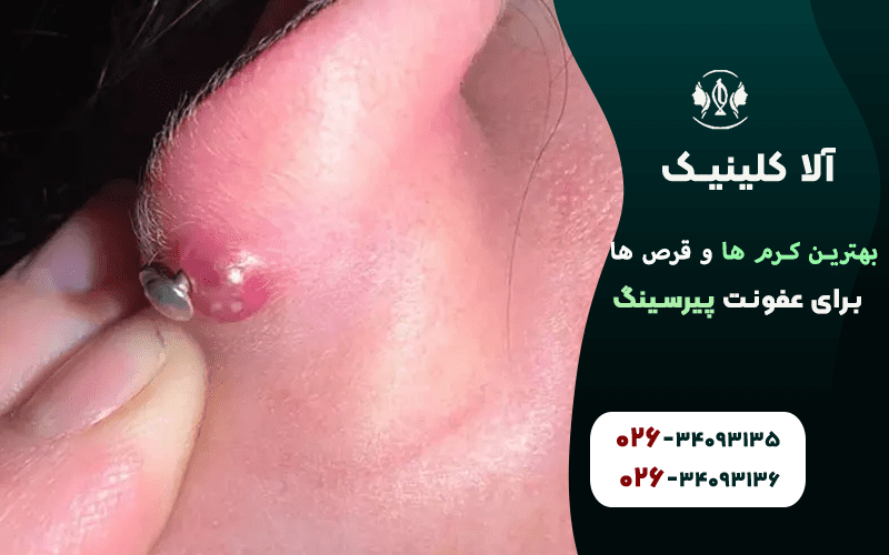 بهترین کرم ها برای عفونت پیرسینگ