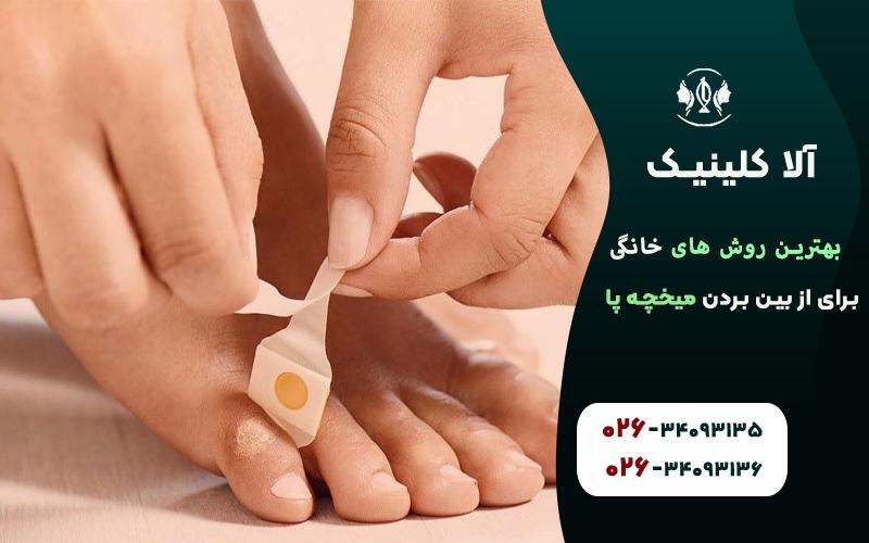 بهترین روش های خانگی برای از بین بردن میخچه پا