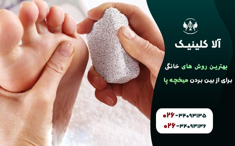 از بین بردن میخچه پا با سنگ پا