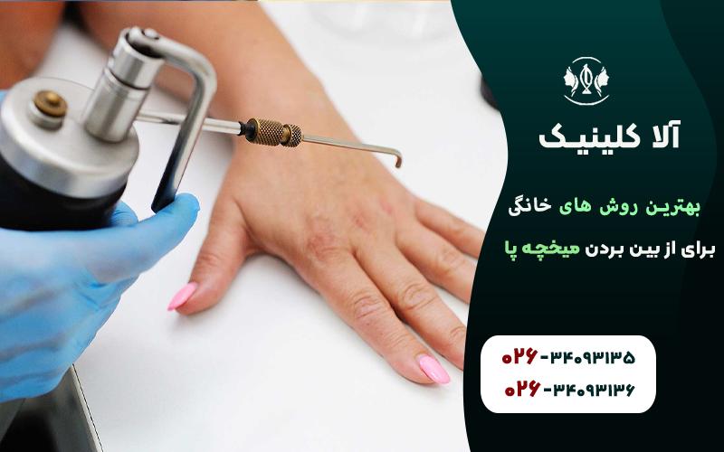 از بین بردن میخچه پا با فریز کردن