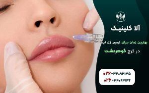 بهترین زمان برای تزریق ژل لب