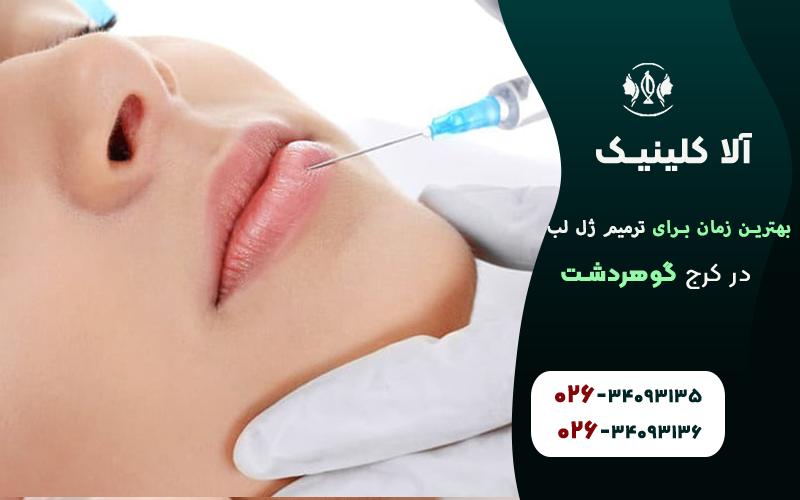 بهترین زمان برای تزریق ژل لب