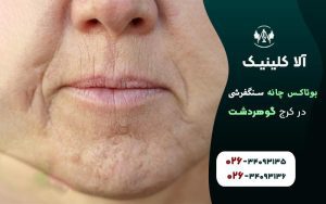 بوتاکس چانه سنگفرشی چیست