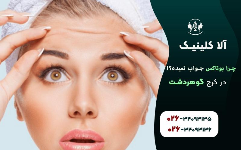 علت تاثیر نداشتن بوتاکس پیشانی