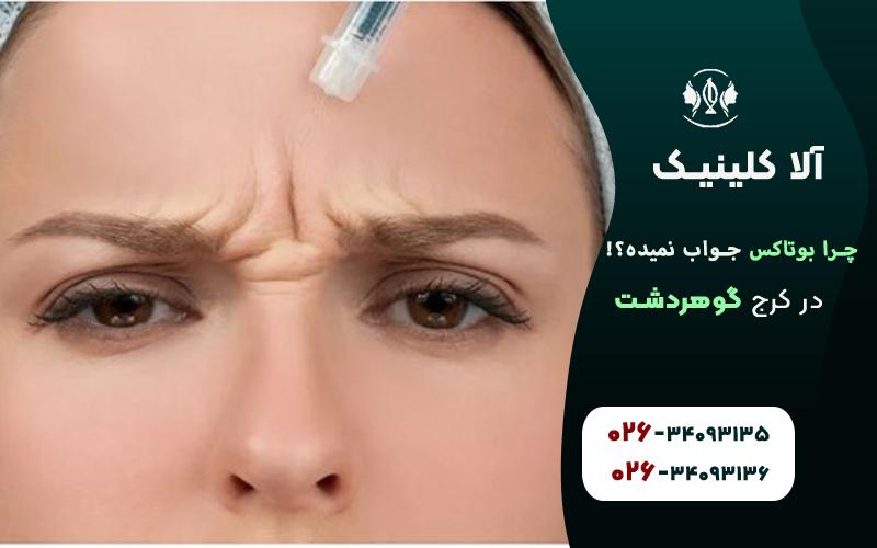 چرا تزریق بوتاکس برای برخی بی تاثیر است