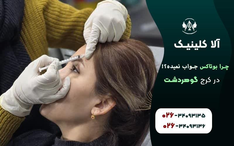 چرا بوتاکس جواب نمیده