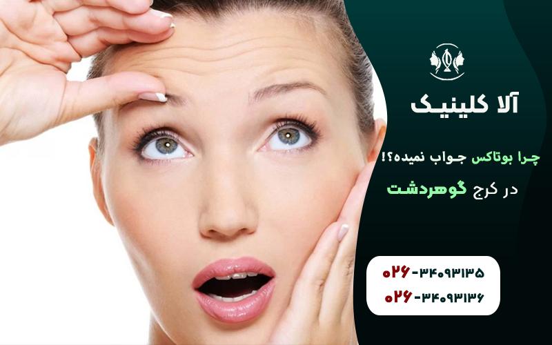 چرا بوتاکس جواب نمیده