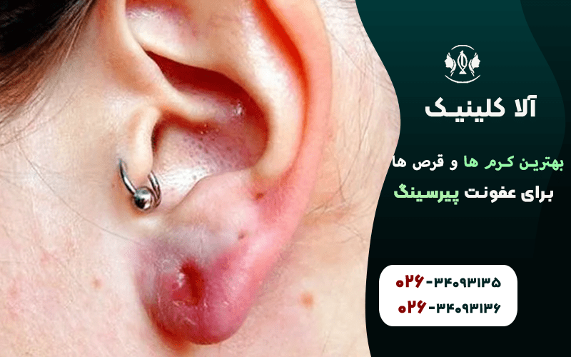 بهترین کرم ها و قرص ها برای عفونت پیرسینگ
