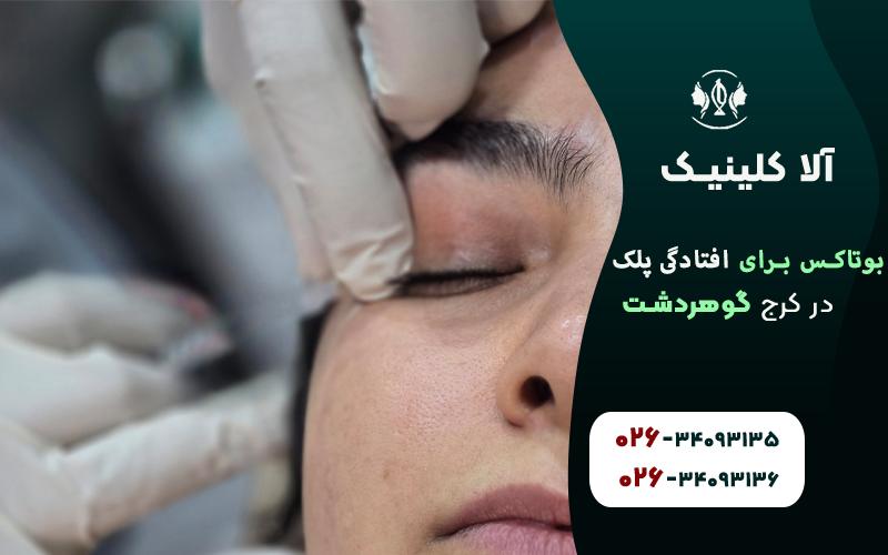 بوتاکس برای افتادگی پلک