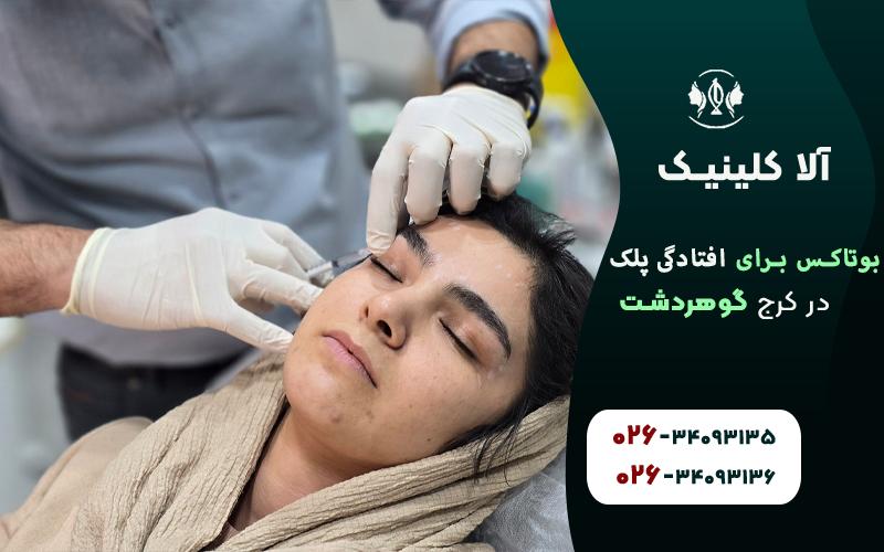 بوتاکس برای افتادگی پلک