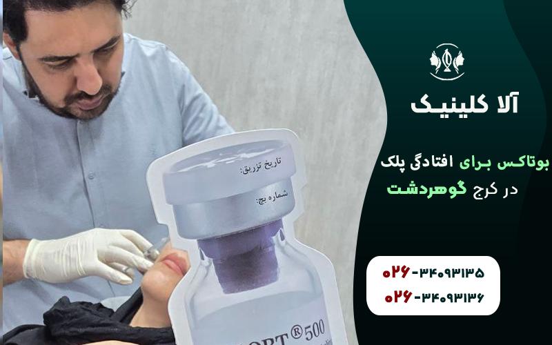 بوتاکس برای افتادگی پلک