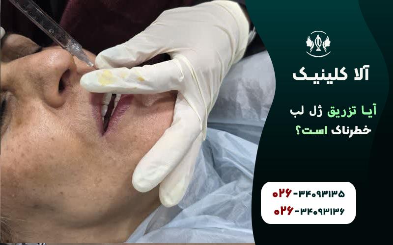 خطرات و عوارض تزریق ژل لب