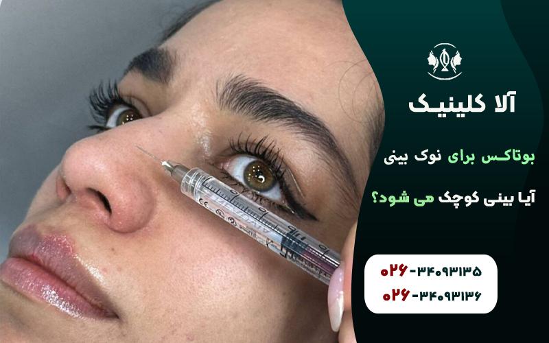 بوتاکس بینی گوشتی