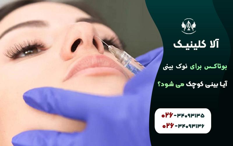 بوتاکس نوک بینی