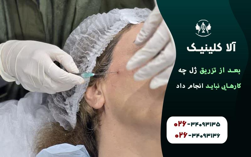 کارهای ممنوع بعد از تزریق ژل