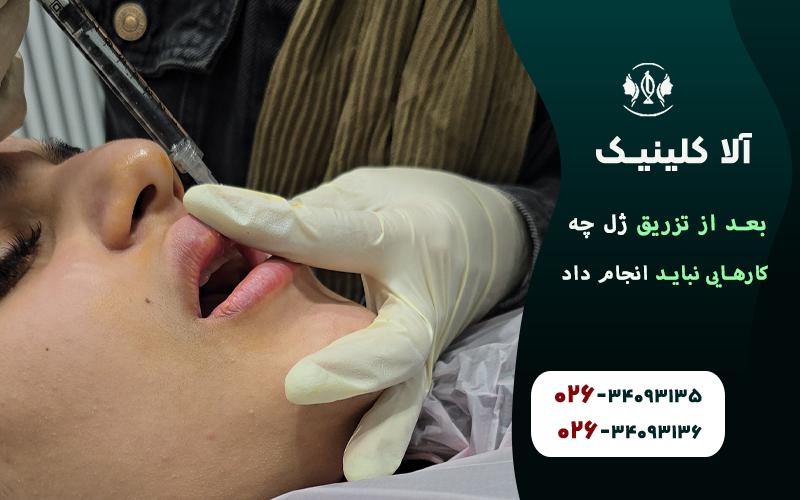 بعد از تزریق ژل چه کارهایی نباید انجام داد