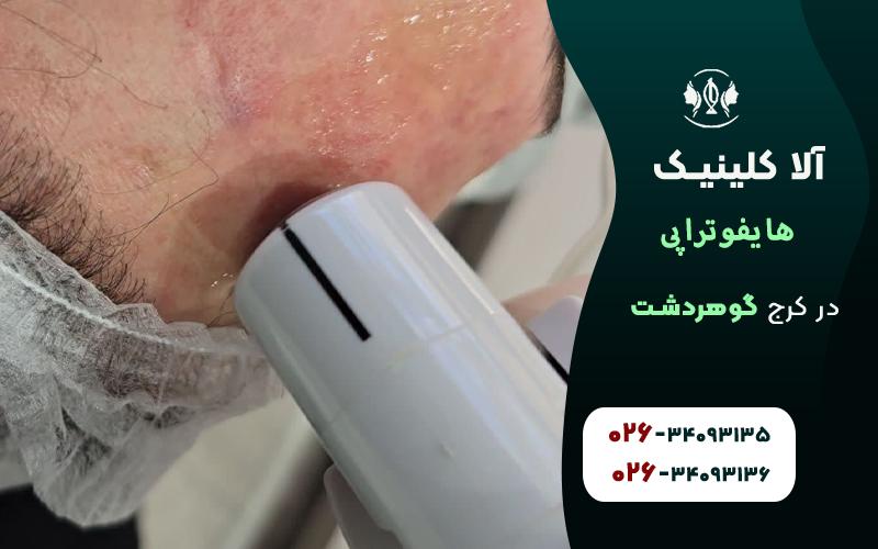 خدمات هایفوتراپی در کرج گوهردشت