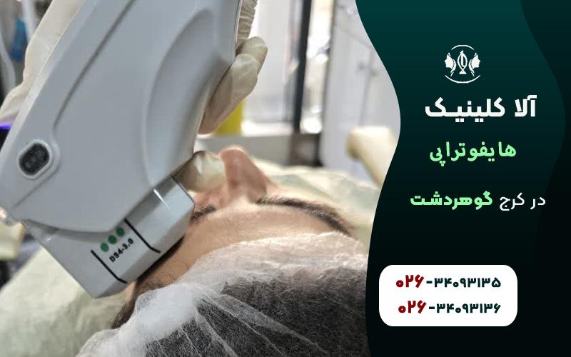 هایفوتراپی صورت در کرج