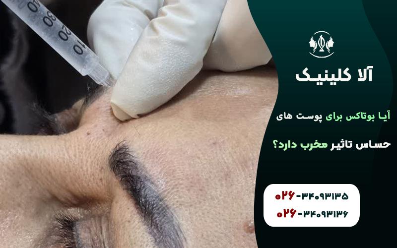 آیا بوتاکس برای پوست های حساس تاثیر مخرب دارد
