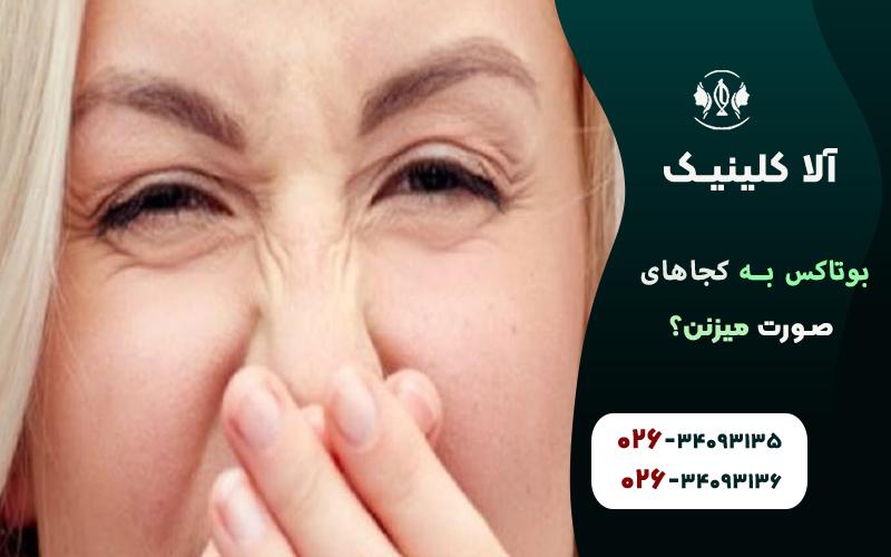 بوتاکس برای خطوط خرگوشی