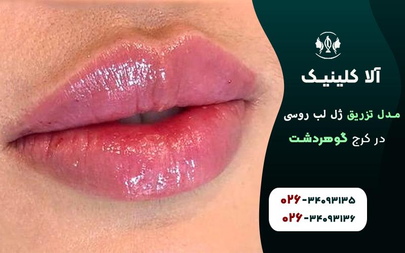 ژل لب روسی طبیعی