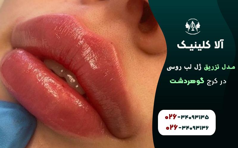 ژل لب روسی عروسکی