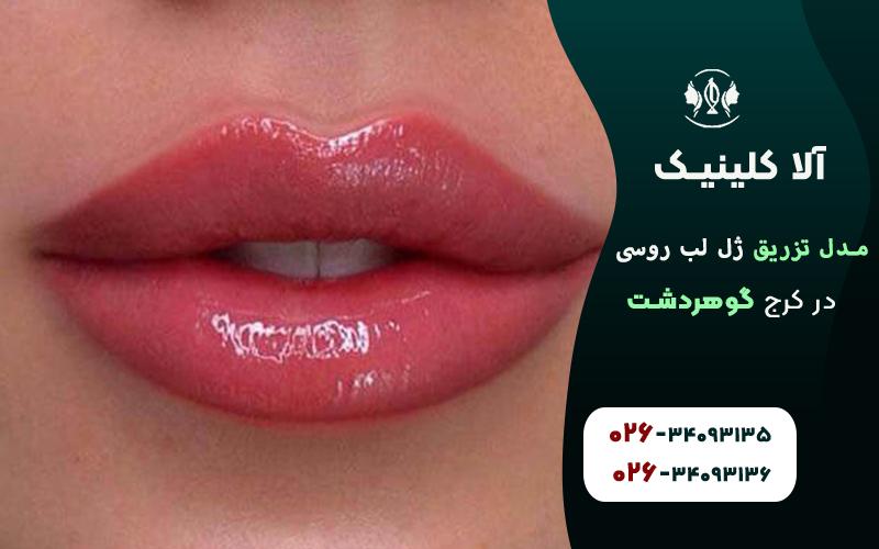 مدل ژل لب روسی نچرال