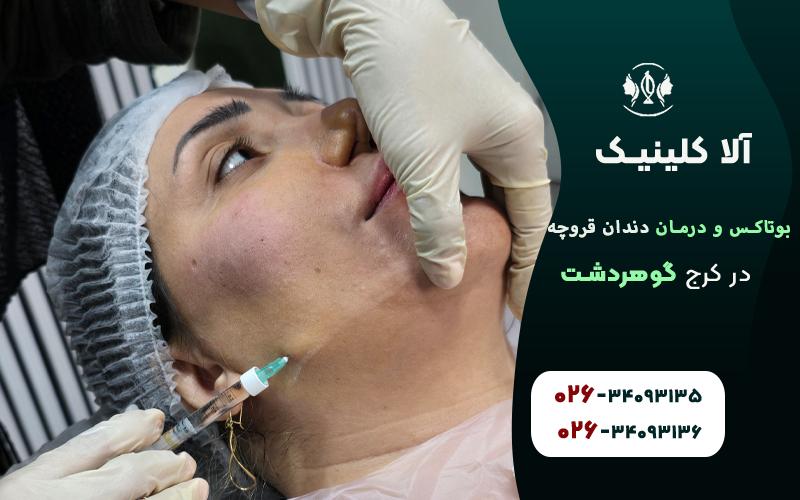 بوتاکس برای از بین بردن دندان قروچه