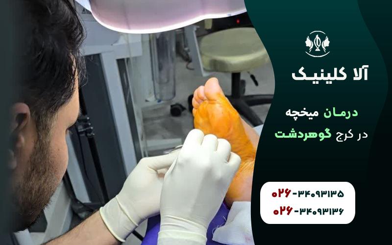 ازبین بردن میخچه پا توسط متخصص