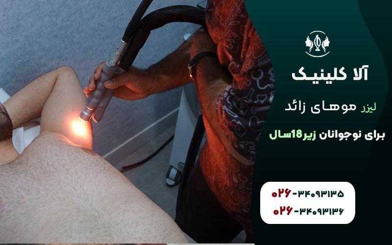 لیزر مو های زائد برای نوجوانان