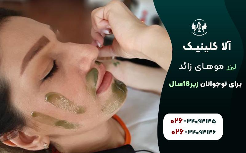 لیزر مو های زائد برای نوجوانان؛ سن زیر 18 سال
