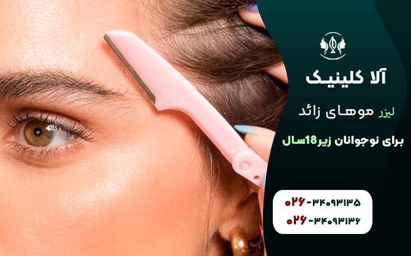 لیزر مو های زائد برای نوجوانان؛ سن زیر 18 سال